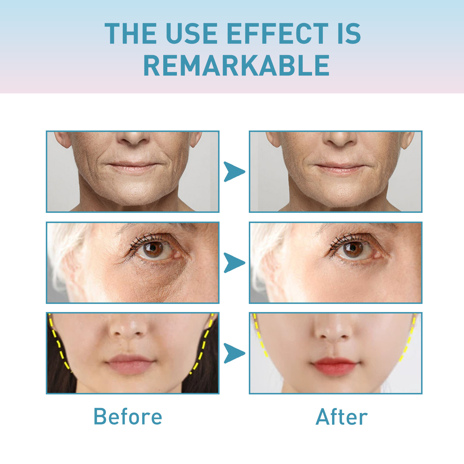Collagen Face Cream Wrinkle Removal Cream Fade Fine Line Firming Moisturizing Tighten Repairing Hydrating Anti Aging