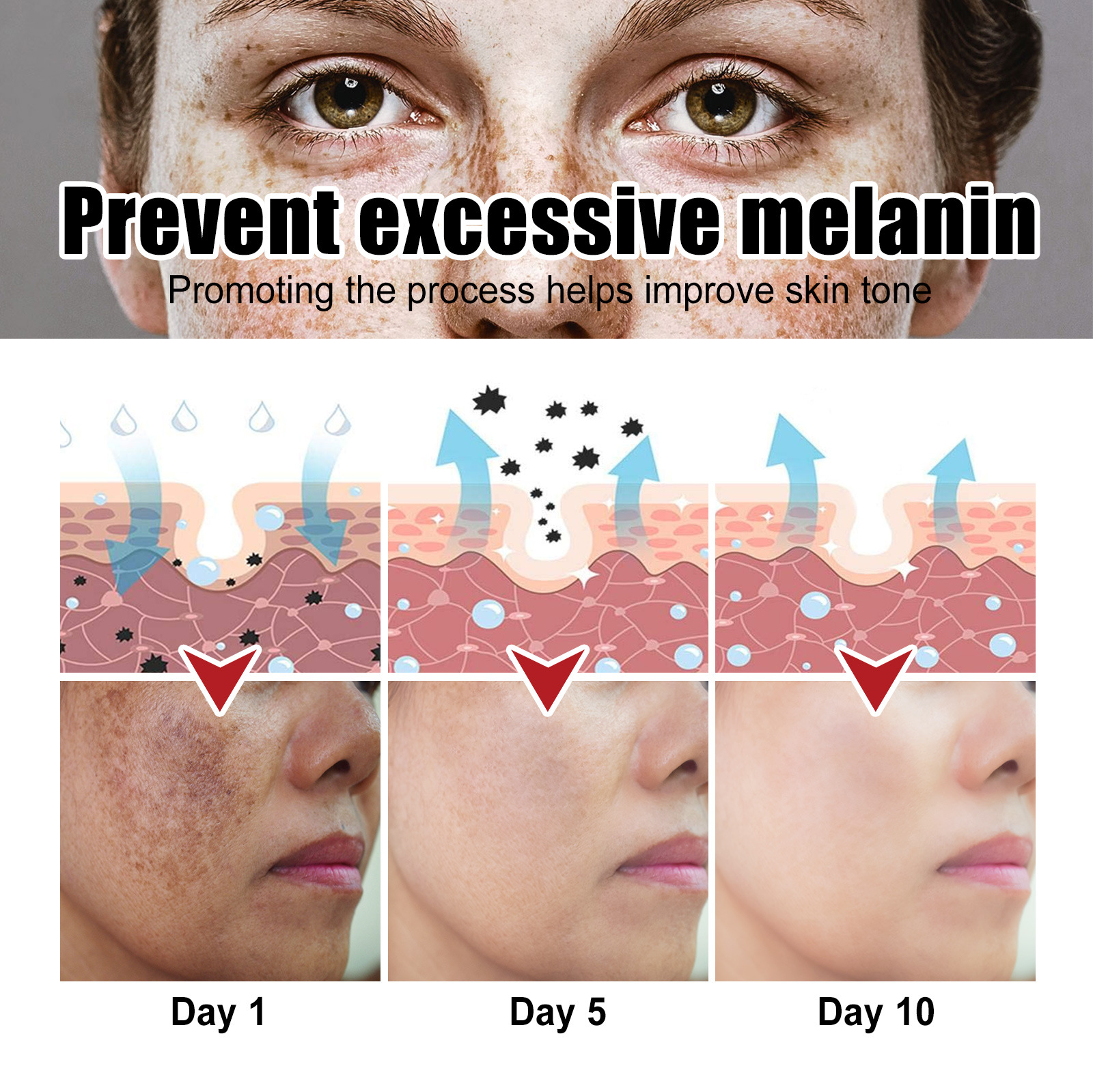 Dark Spots Corrector Anti Dark Spot Cream Whitening Facial Cream Repair Fade Freckles Melanin Remover Brighten Moisturizing Improving Facial Dullnes