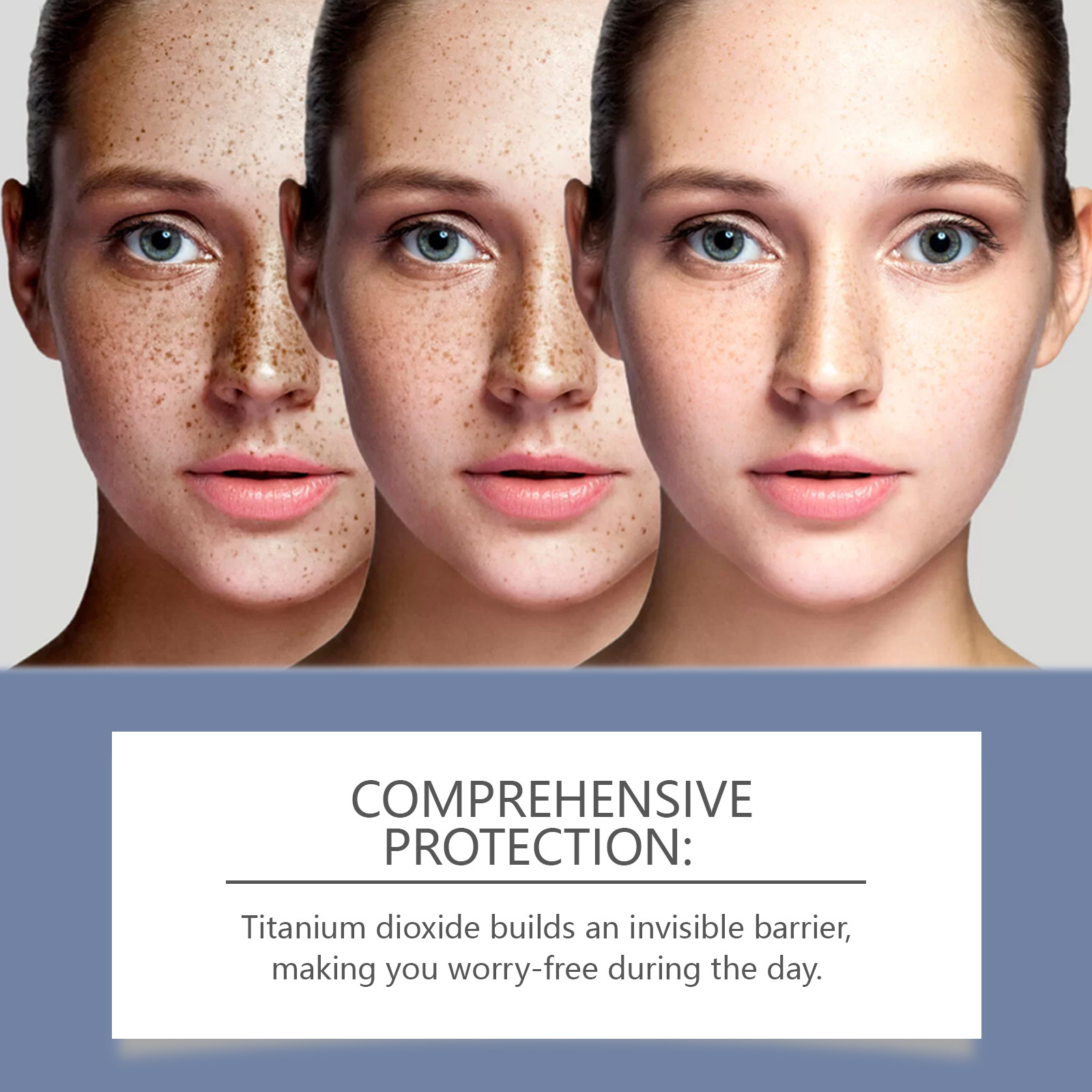OUHOE Freckle Remover Cream Face Removing Dark Spot Melasma Chloasma Senile Plaques Sunburn Cyasma Chorioplaque Freckle