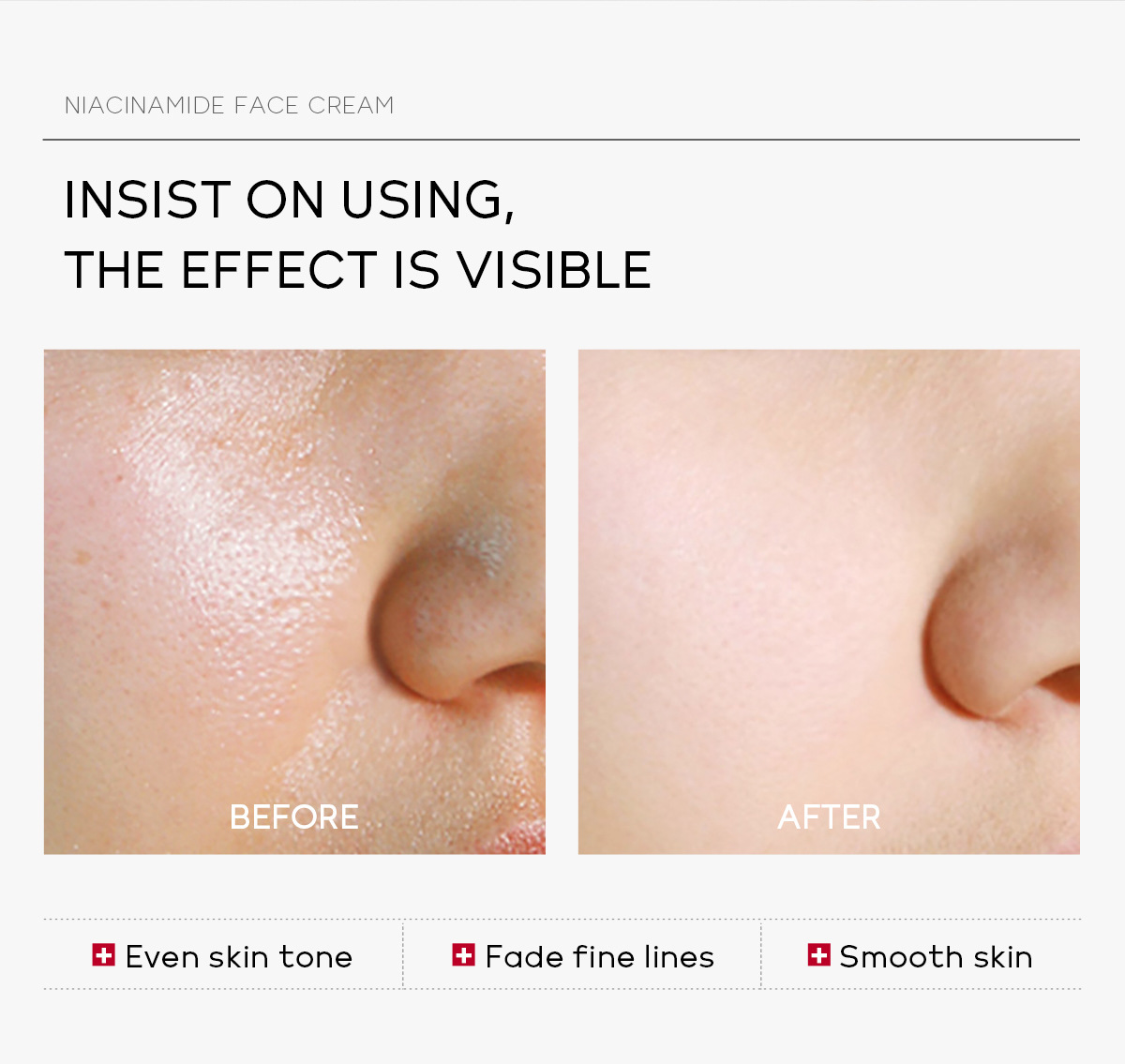 Whitening Freckle Cream Melasma Pigmentation Remove Nicotinamide Serum Cream Pores Refining Black Spot Acne Marks Removal Cream