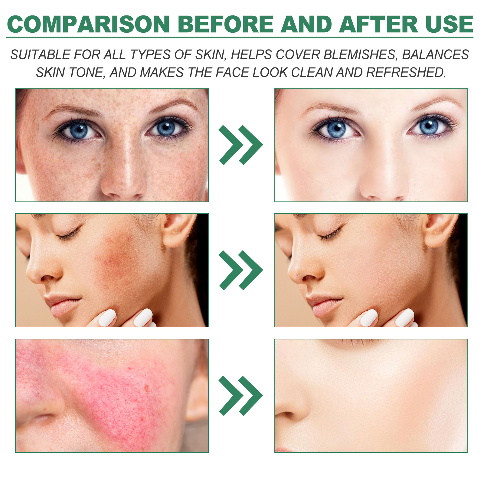 (1 PC) Color Correction Treatment Cream Lighten Spots Relieve Sunburn Repair Dull Moisturizing Cream Improve Dullness Skin Tone Anti Dark Spots Lotion Skin Care
