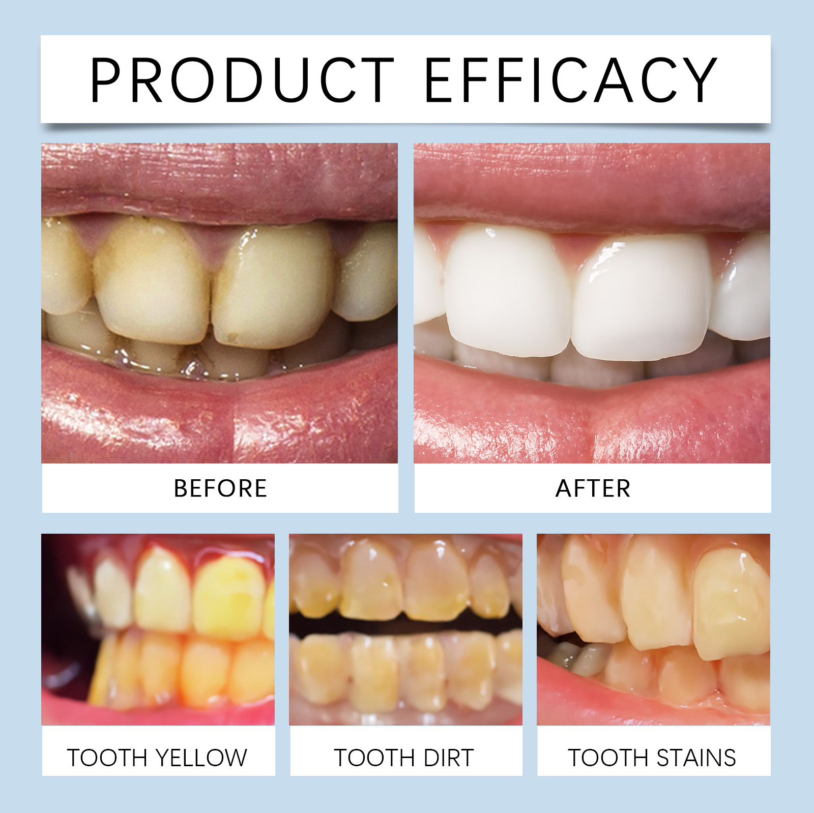 Whitening Dental Mousse Mild Ingredients Daily Cleaning Bright Teeth Portable Mint Scent Fresh Oral Care