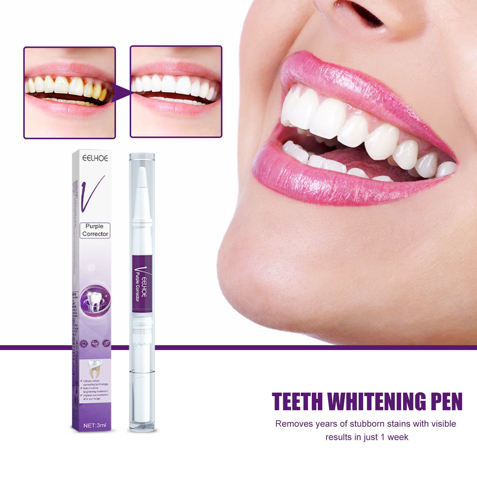 V34 Purple Teeth Whitening Pen Oral Care Stain Removal Brightening For Daily Use
