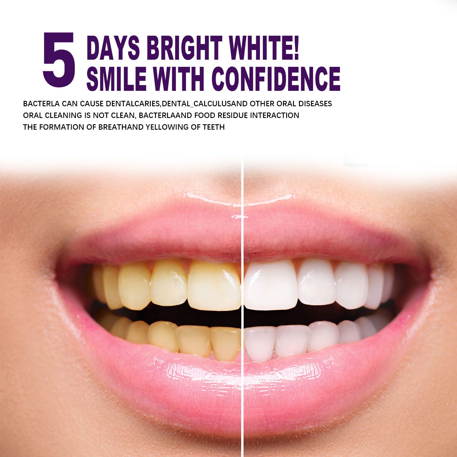 V34 Purple Teeth Whitening Pen Oral Care Stain Removal Brightening For Daily Use
