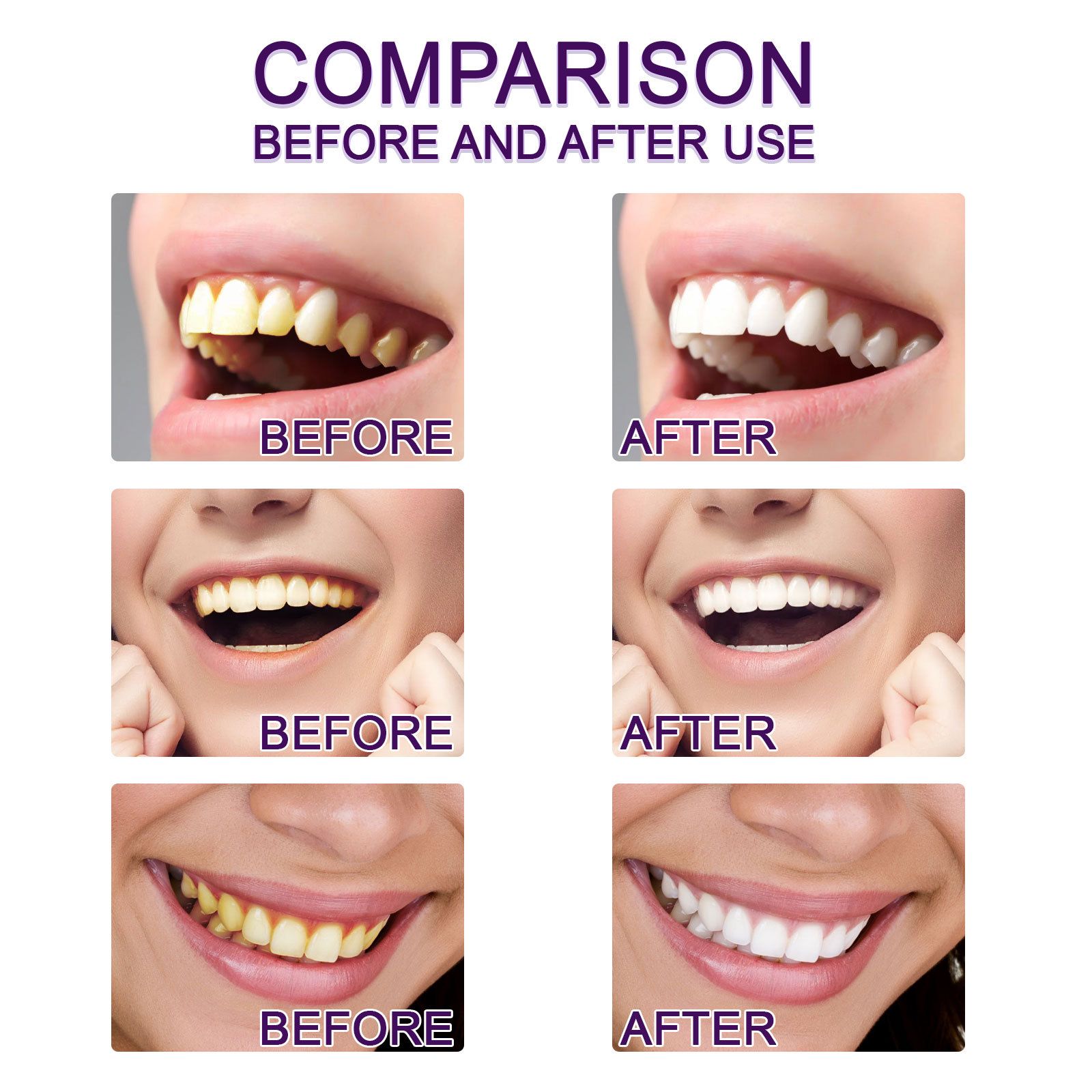 V34 Purple Teeth Whitening Pen Oral Care Stain Removal Brightening For Daily Use