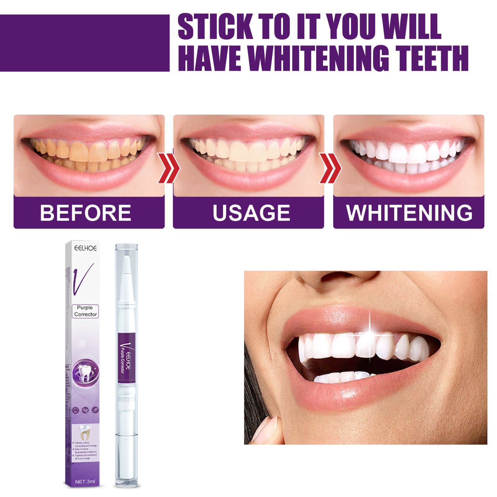 V34 Purple Teeth Whitening Pen Oral Care Stain Removal Brightening For Daily Use
