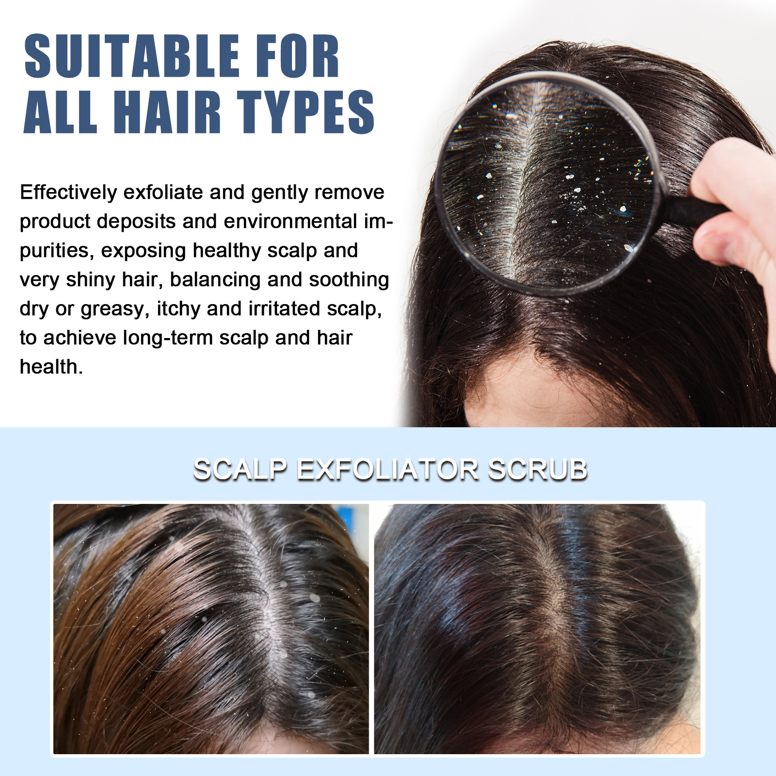 Scalp Exfoliating Scrubs Hair Scratcher Scalp Oil Nutritional Effectively Repairs Damaged Dry Hair Restore Smoothness Promote Scalp Cleanse Treatment