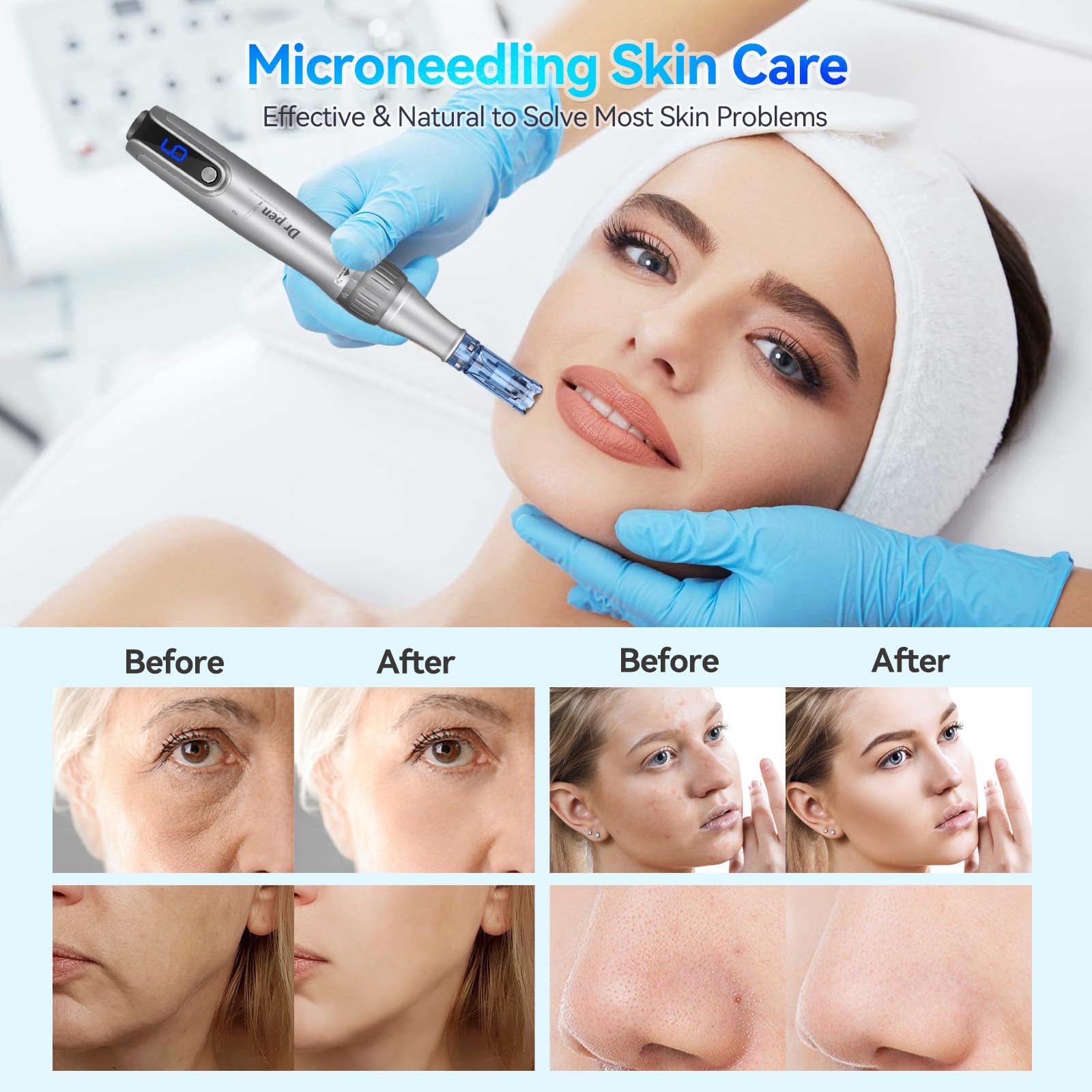 (Derma Pen M8S) Microneedling Dr.pen M8S Professional Dermapen Wireless Microneedling Pen Electric Derma Pen with 6pcs 12PIN 36PIN Cartridges Micro Needle Replacement