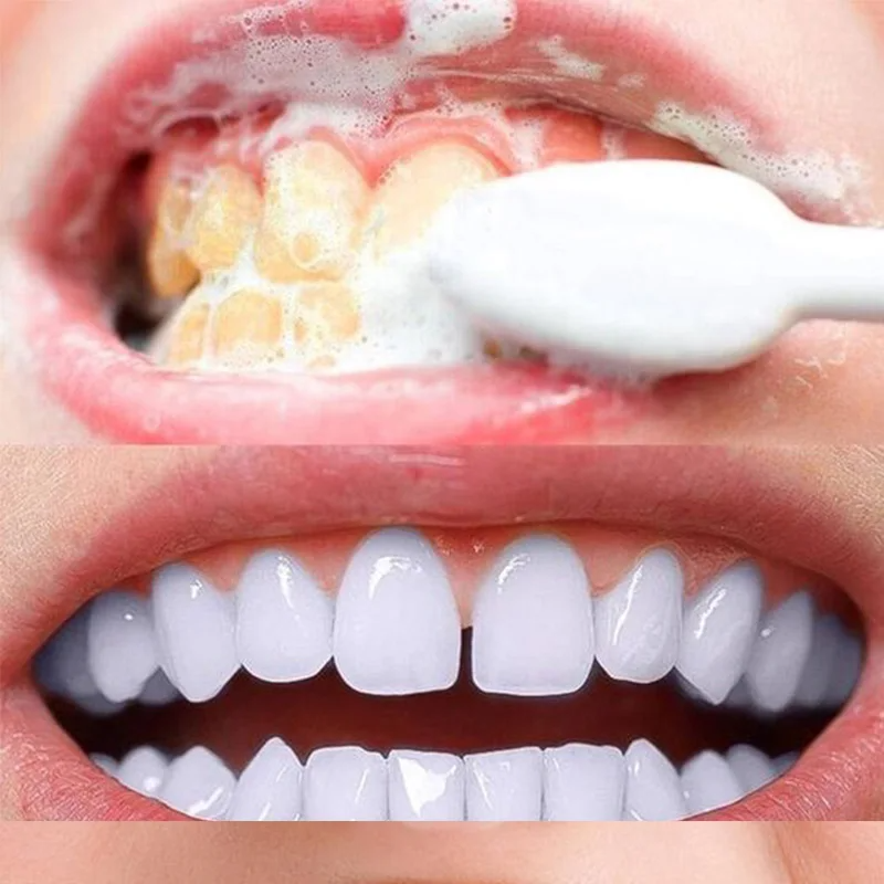 Whitening Teeth Brightening White Powder Reducing Tooth Stains Yellowing Teeth Stains Smoke Stains Dental Plaque Dental Care Teeth Whiteners