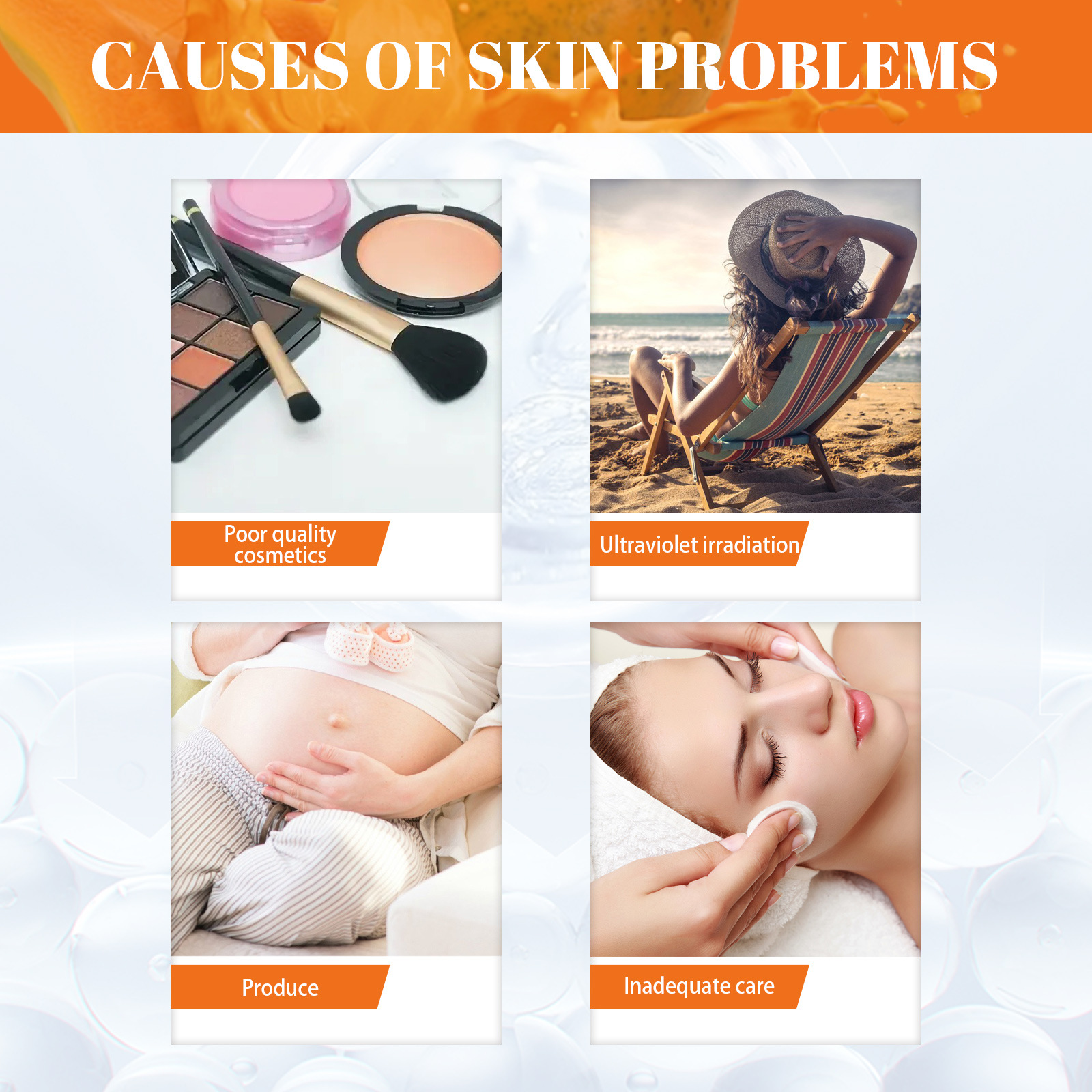 Whitening Freckle Cream Melanin Blemish Remover Lighten Pigmentation Melasma Removal Whiten Nourish Dark Spot Corrector Cream Day Night Cream