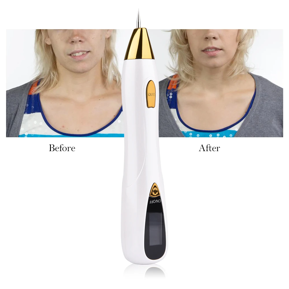 Min Freckle Mole Removal Pen Portable Removal Sweep Spot Wart Corn Dark Remover Skin Laser Plasma Pen Mole Tattoo Skin Care Salon Beauty Tools