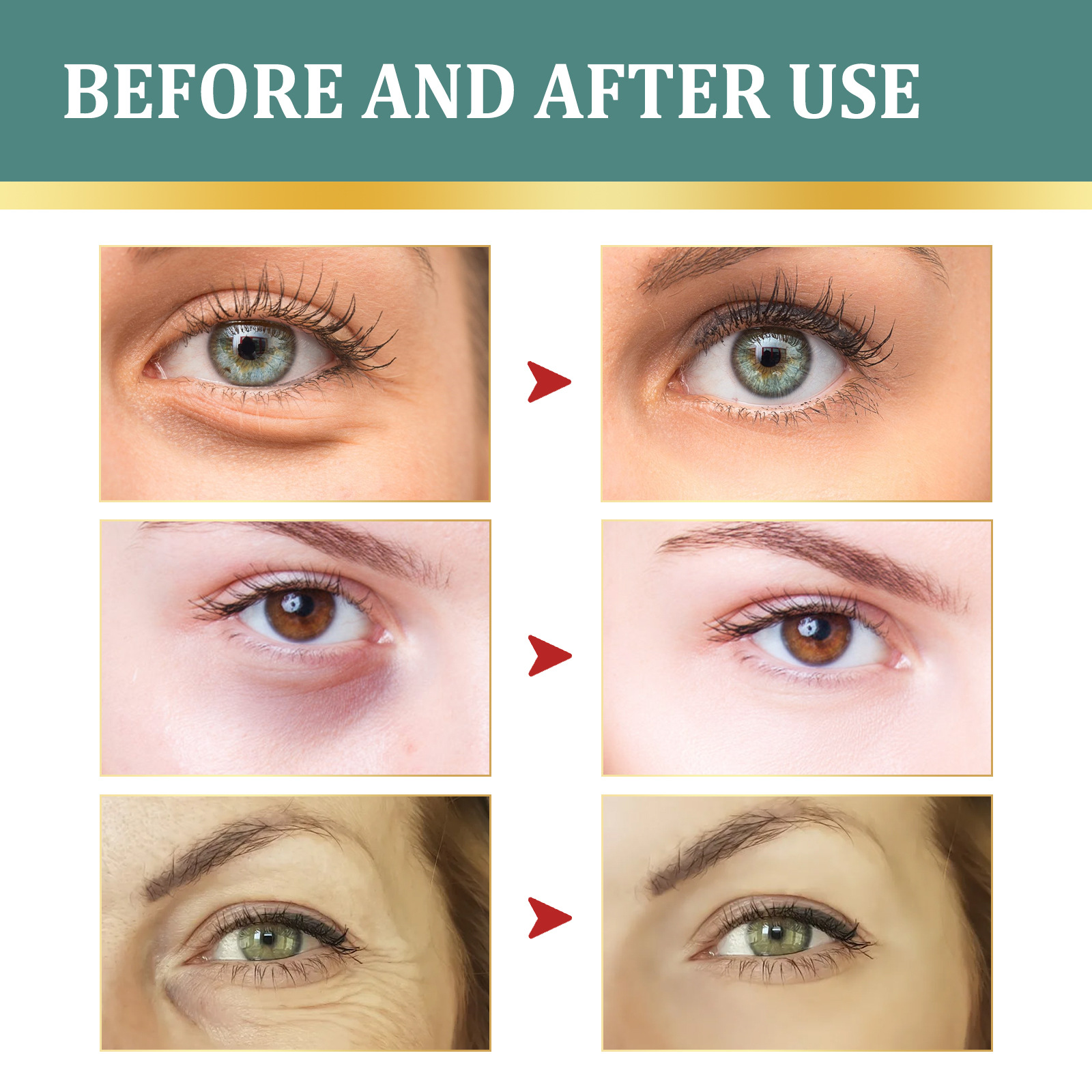 EELHOE Eye Cream Jasmine Ointment for Lightening Dark Circles Remove Eye Bags Puffiness Lifting Firming Eyes Care Moisturizing Anti Wrinkle Eye Cream