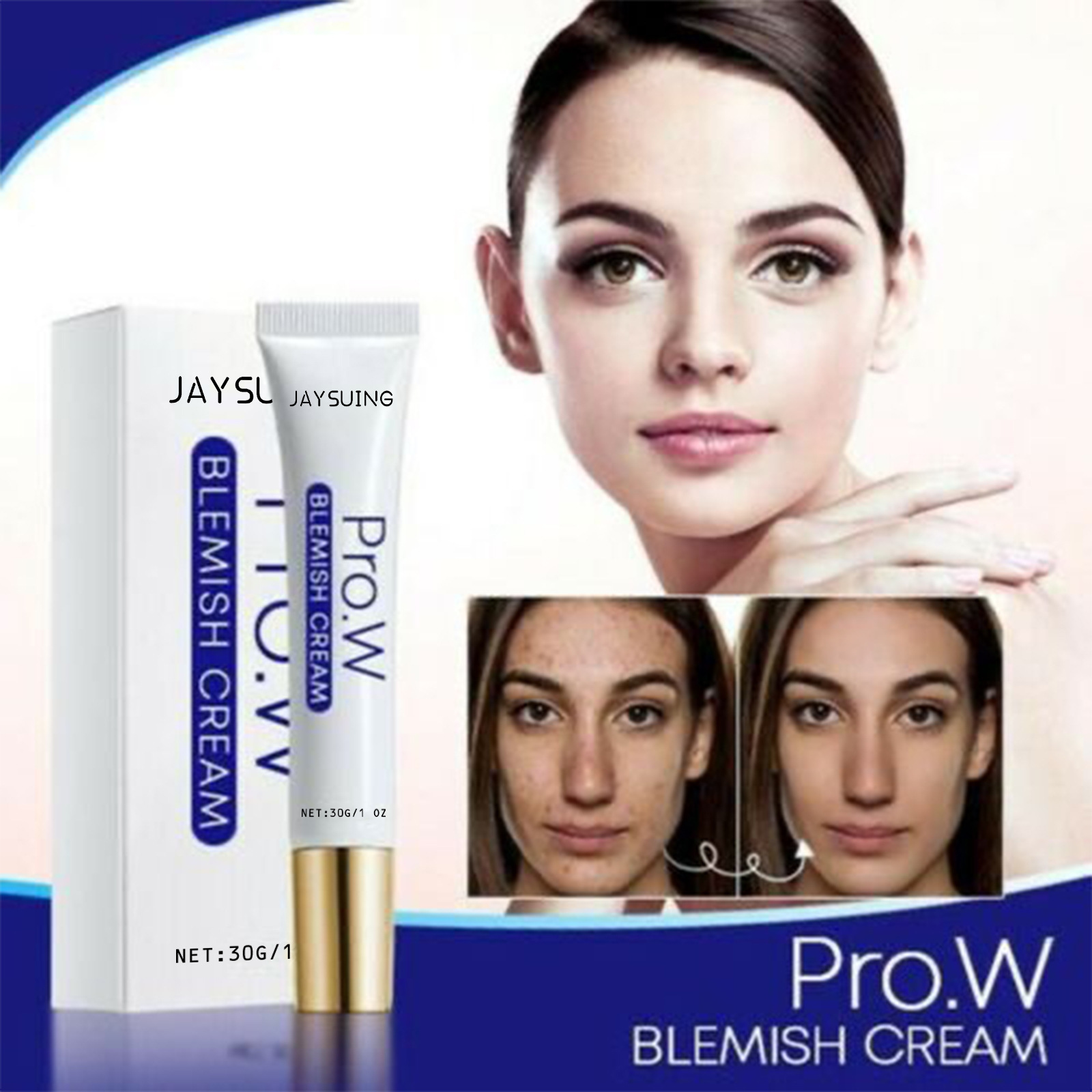 (1 PC) Acne Pockmarks Removal Face Cream Freckle Remover Facial Cream Lighten Acne Mark Acne Spot Cream Hydrating Lift Moisturizing Firming Repair Cream.