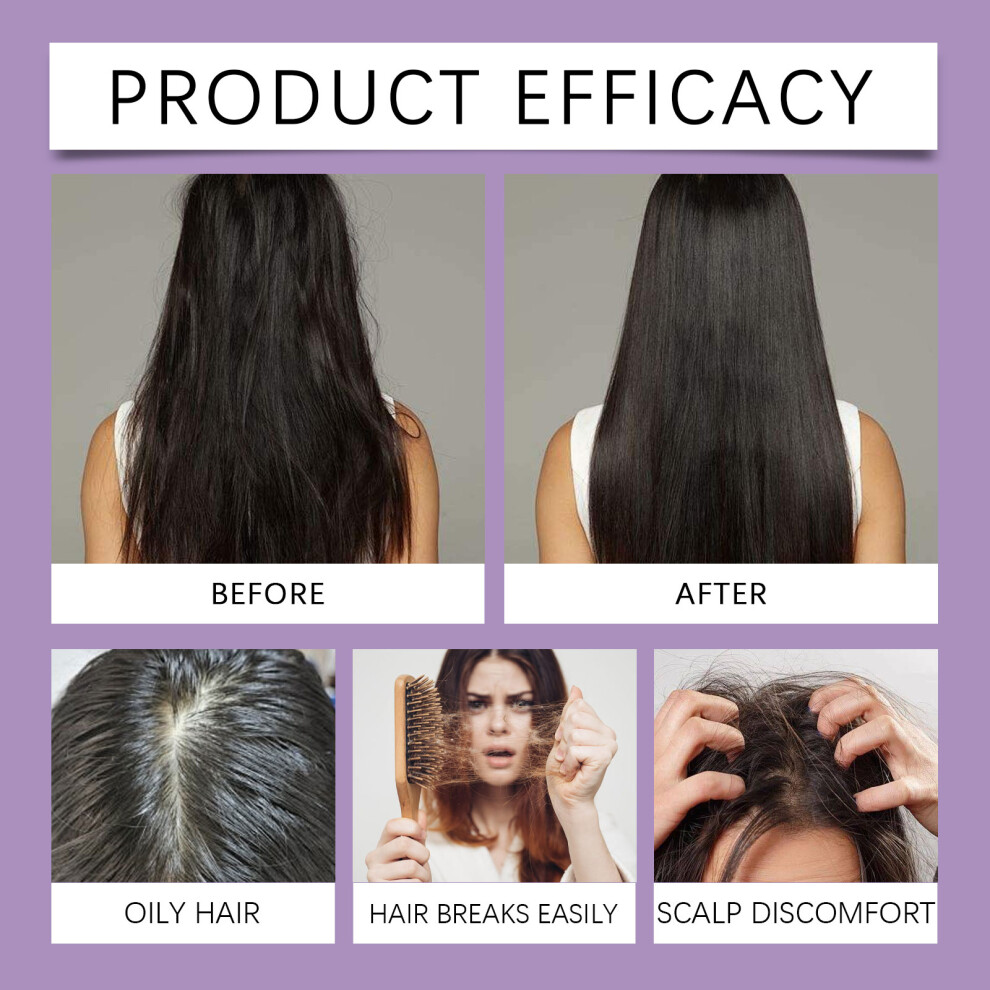 5Bottle Hoegoa Minoxidil Foam