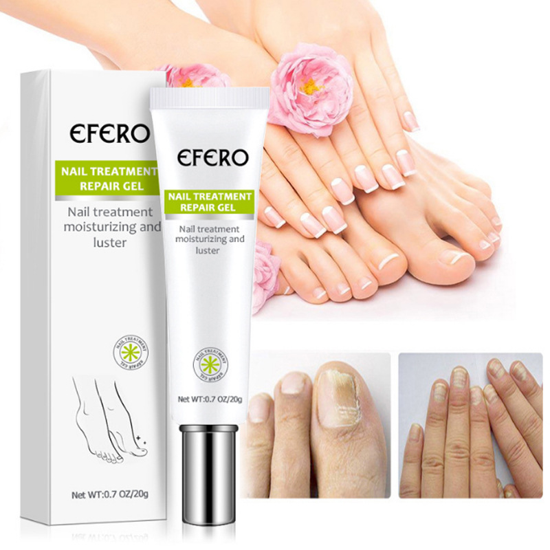 Nail Repair Cream Moisturizing Strengthening For Brittle Damaged Nails Daily Home Manicure Care 20g