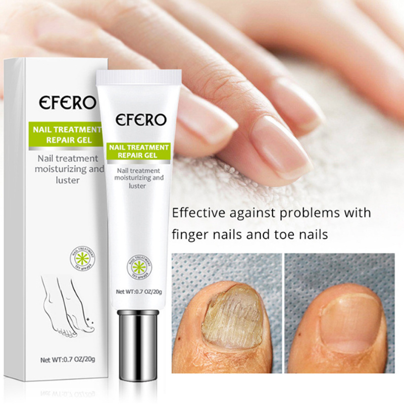 Nail Repair Cream Moisturizing Strengthening For Brittle Damaged Nails Daily Home Manicure Care 20g