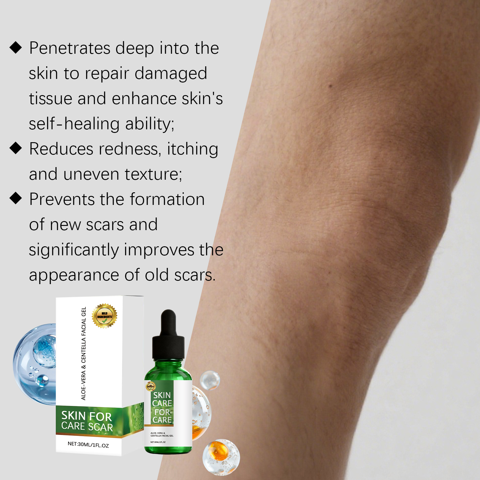 Herbal Skin Care Gel Mild Formula Skin Imperfection Tender Daily Skin Nourishing Care