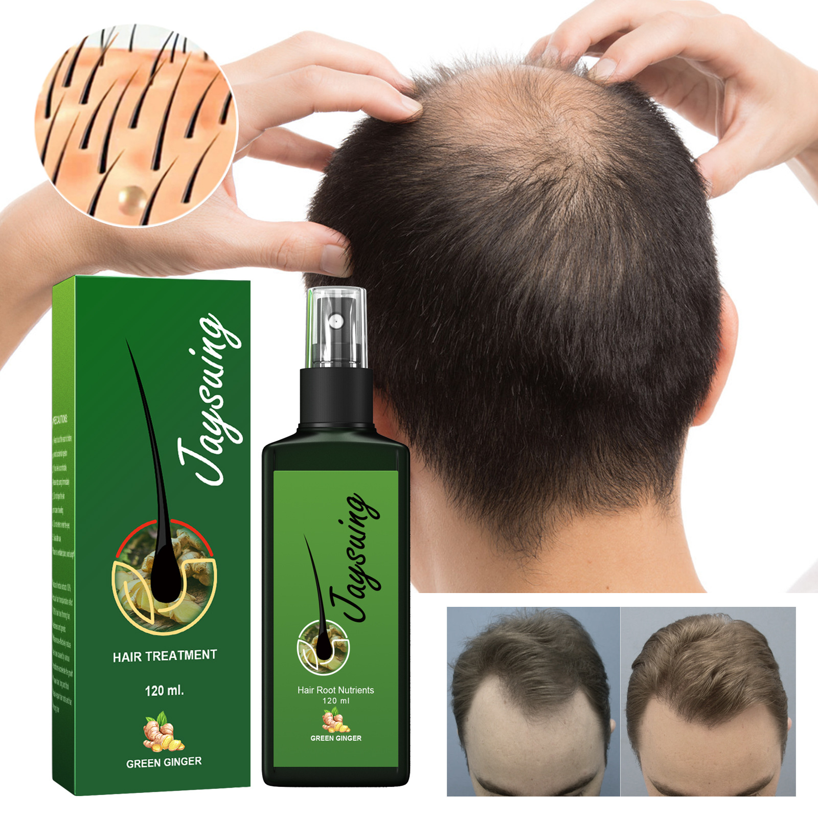 (30ml) Hair Growth Serum Hair Lotion Ginger Serum Hair Spray Anti Loss Promotes Thicker Natural Nourishing Hair Care for Men Women