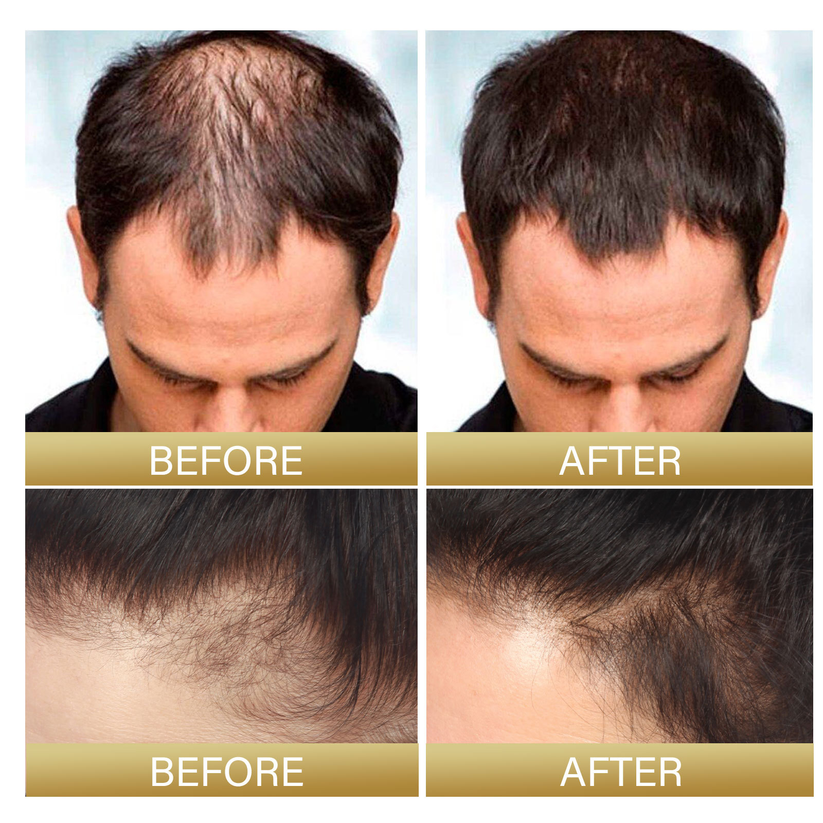 Hair Growth Spray Black Rice Water Spray Strengthen Hair Root Repair Damage Restore Hair Prevent Hair Thinning Dry Repair Hair Care For All Hair Types