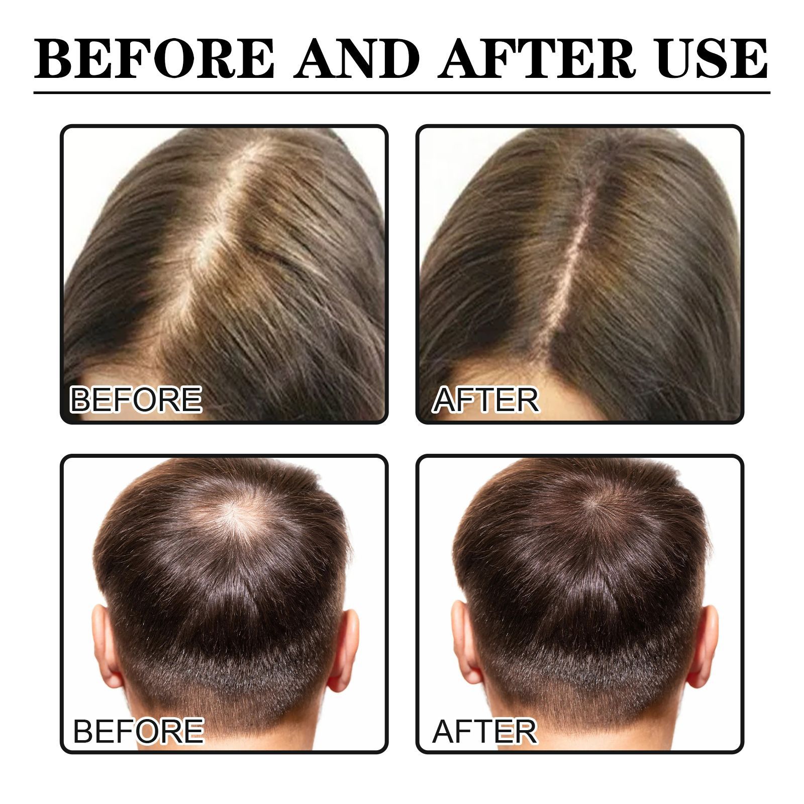 Hair Growth Serum Hair Care Essence Beard Essential Oils Moisturizing Hair Essence Natural Thickening Baldness Unisex