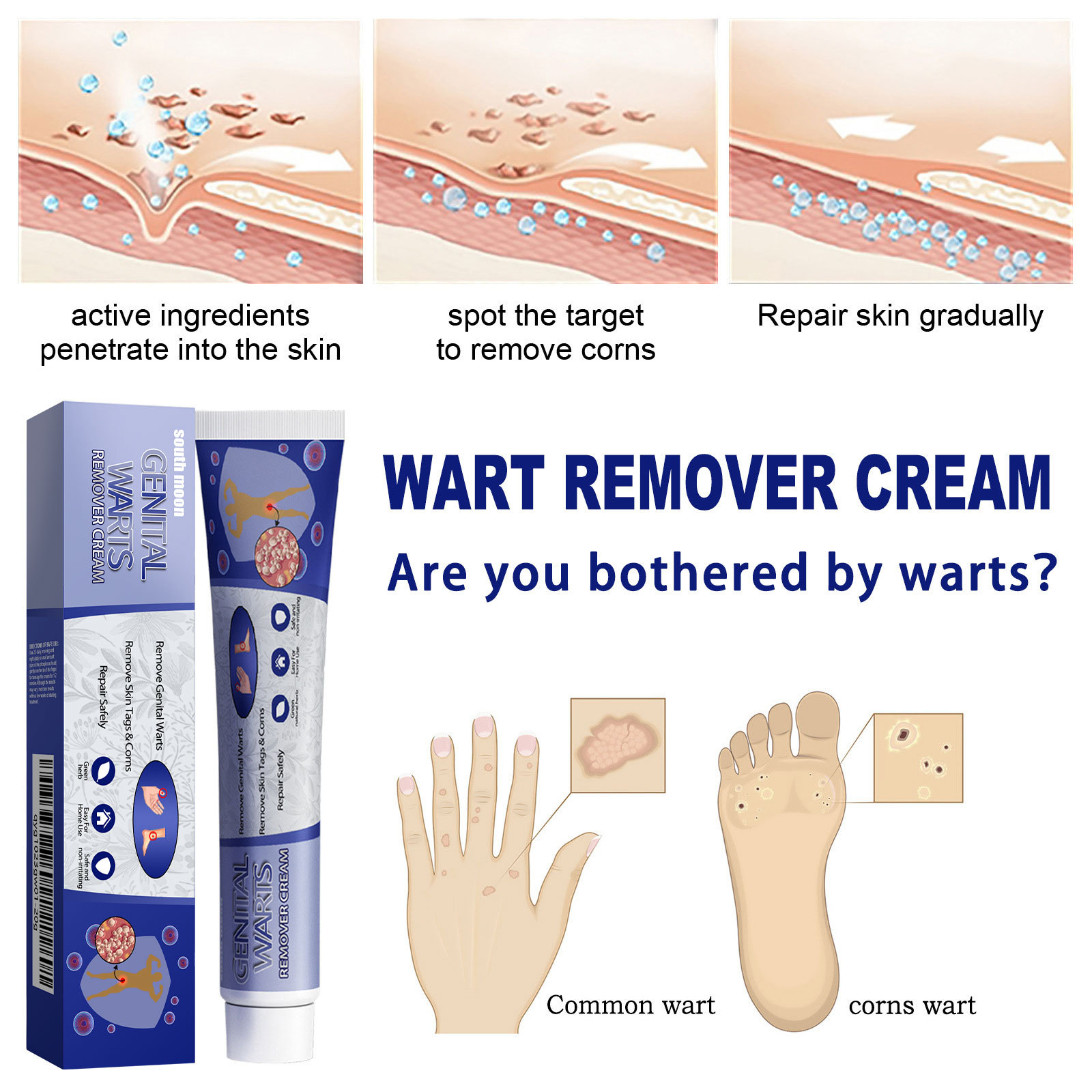 South Moon Skin Tag Remover Liquid Kit Wart and Tag Remover Wart Remover Fast Acting and Painless  for Body Anti Acne Face Cream Natural Safe Mole Remover