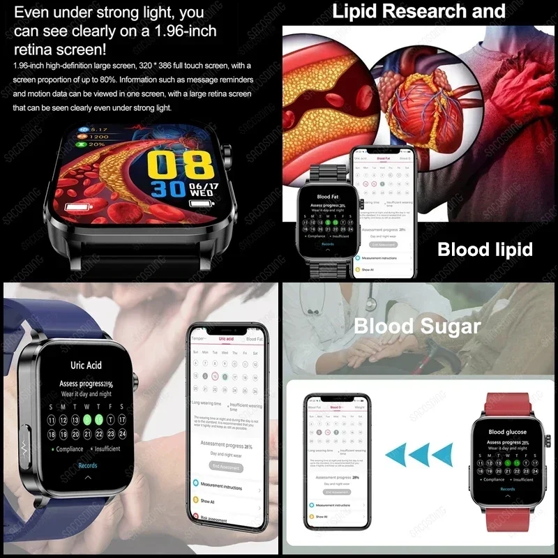 ECG+PPG Blood Lipids Uric Acid Blood Glucose Smart Watch