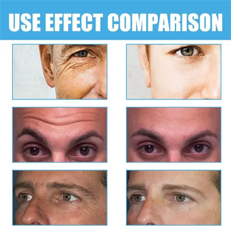 iBeaLee Retinol Whitening Cream Vitamin A Hydrating Nourishing Collagen Anti Aging Face Neck Anti Wrinkle Repair Cream Moisturize Firming Skin care