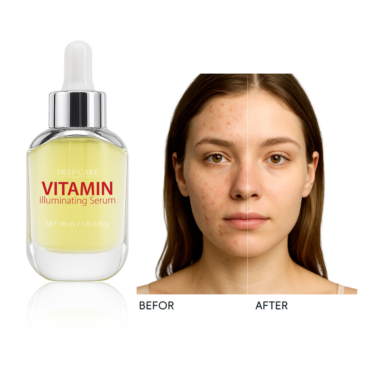 Vitamin Brightening Essence Even Skin Tone Radiance Boosting Daily Face Treatment 30ml