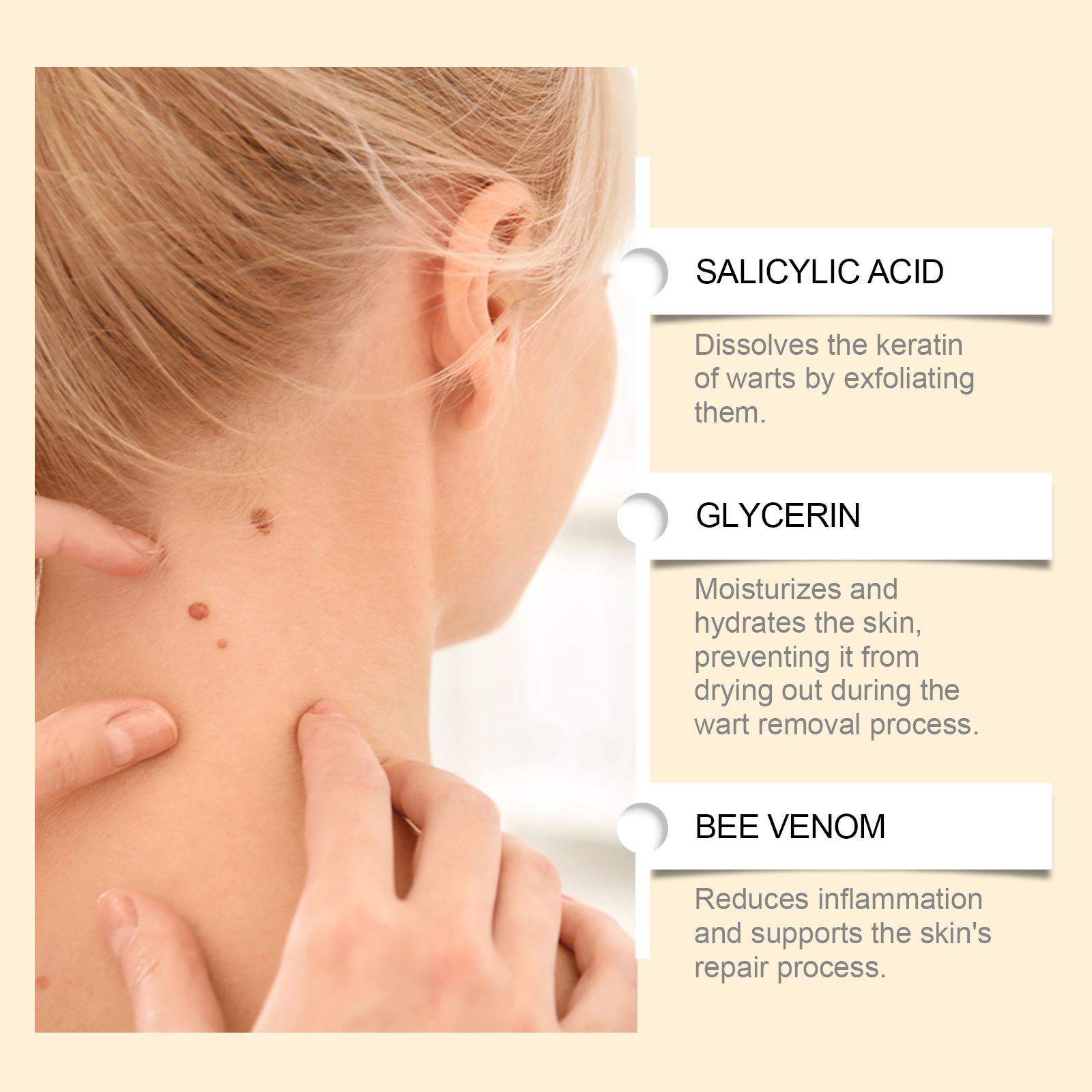 Bee Venum Skin Care Cream Mild Herbal Formula Soft Smooth Skin Daily Clearing Wart Removing Lotion Cream