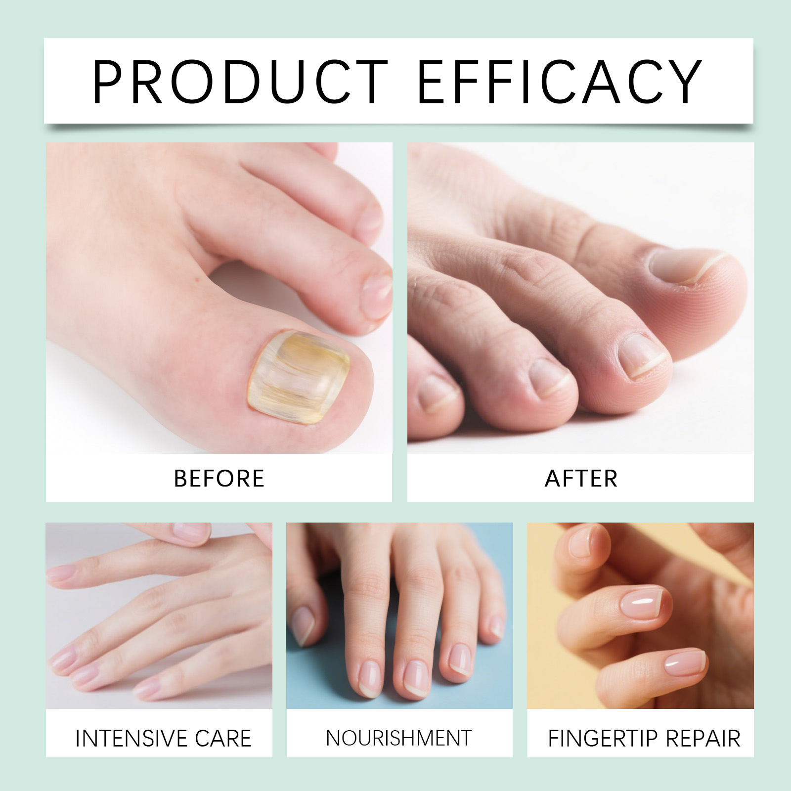 Nail Nourishing Oil Pen Repair Smooth Moisturizing Gentle Formula Nourish Hydrate Daily Hand Foot Nail Care