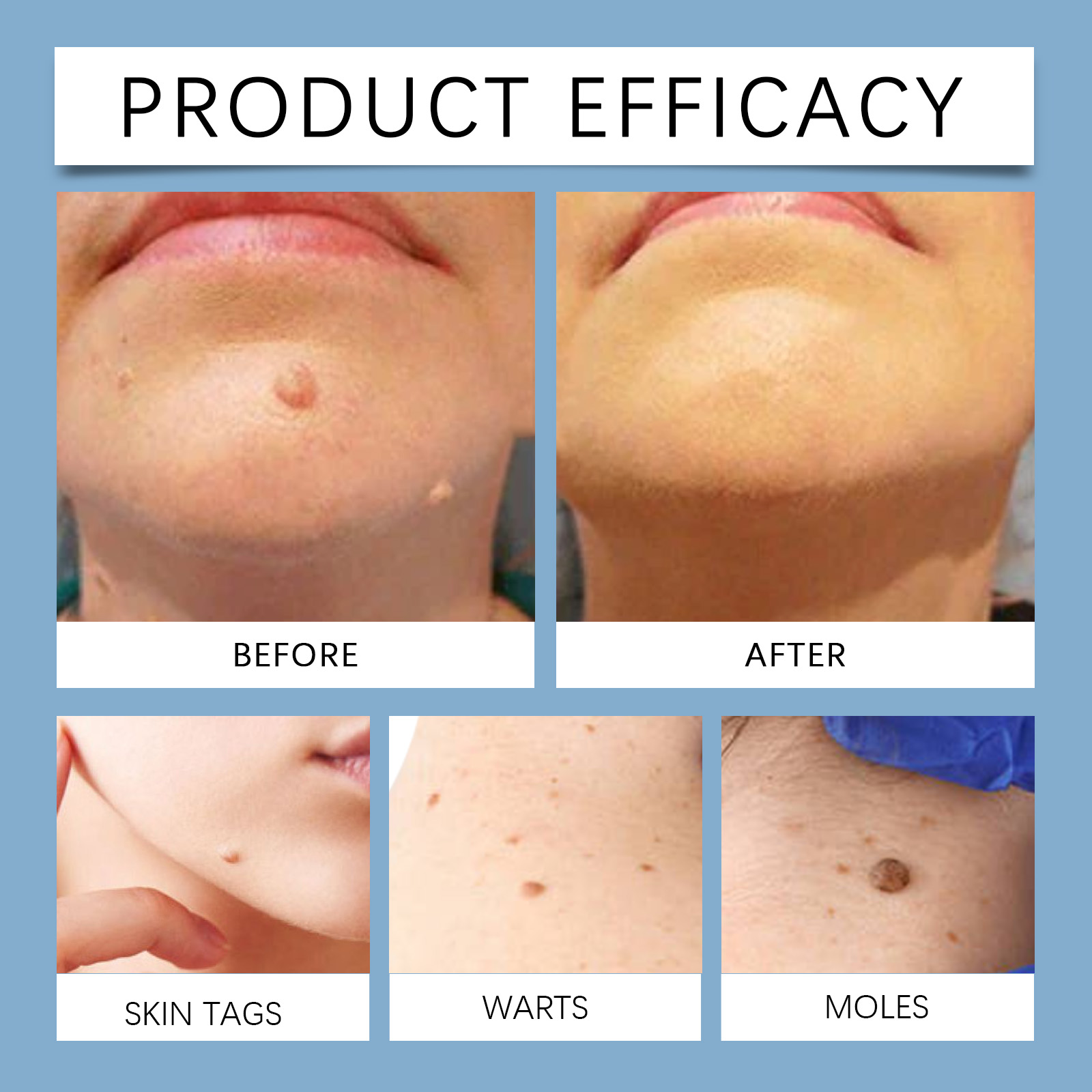 Facial Care Ointment Mild Formula Nourishes Skin Clears Warts External Use Protects Facial Skin Cream