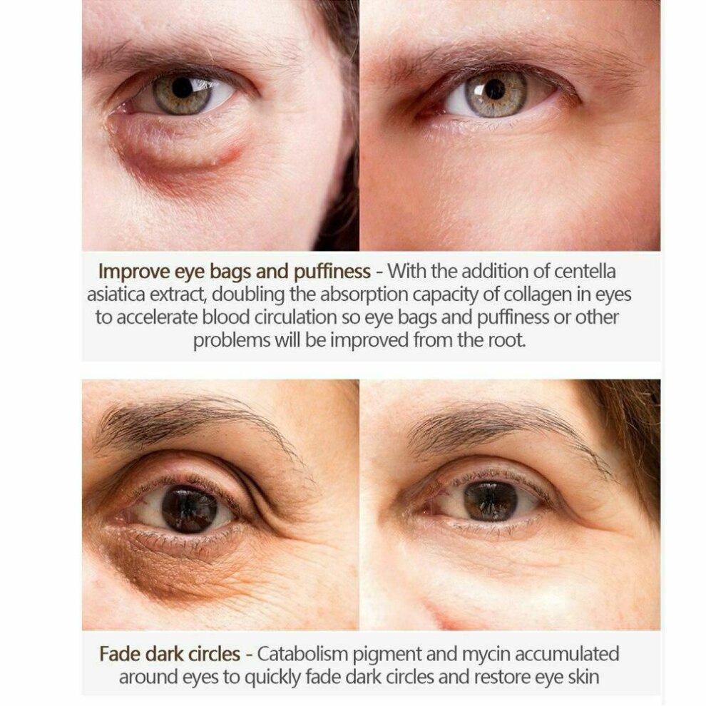 Magic Eye Cream Removal Dark Circle Anti-Wrinkle Eye Repair