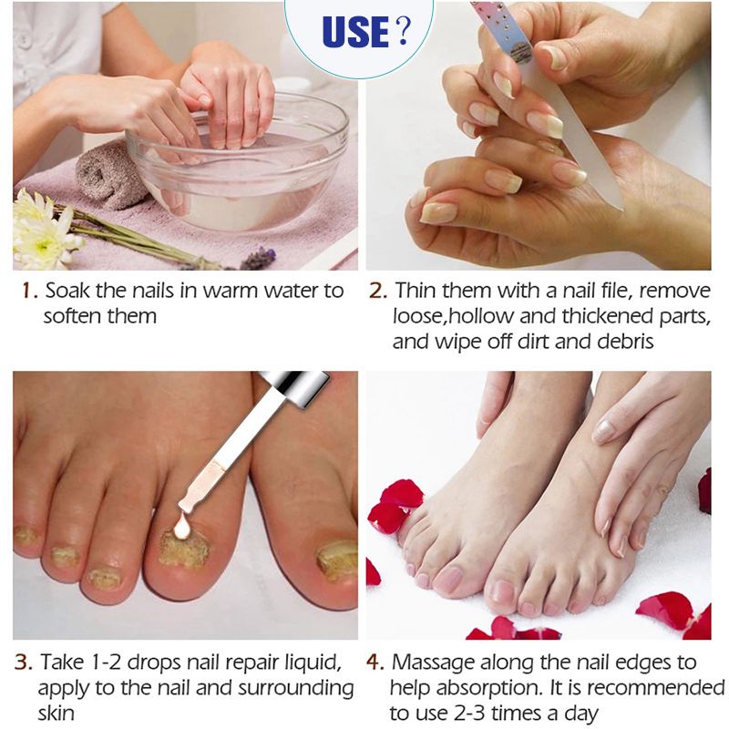 iBeaLee 7 Days Nail Fungus Serum Nail Repair Liquid