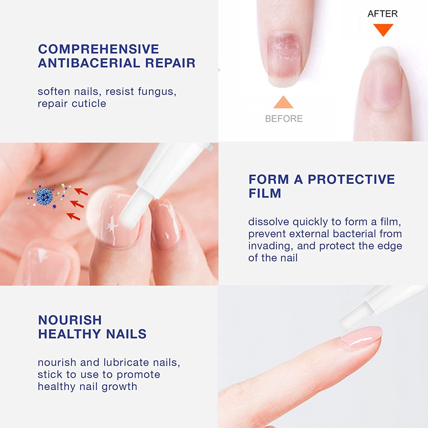 iBeaLee Toenail Fungus Treatment Nail Repair Solution Pen for Toenail and Fingernail Maximum Strength Manicure