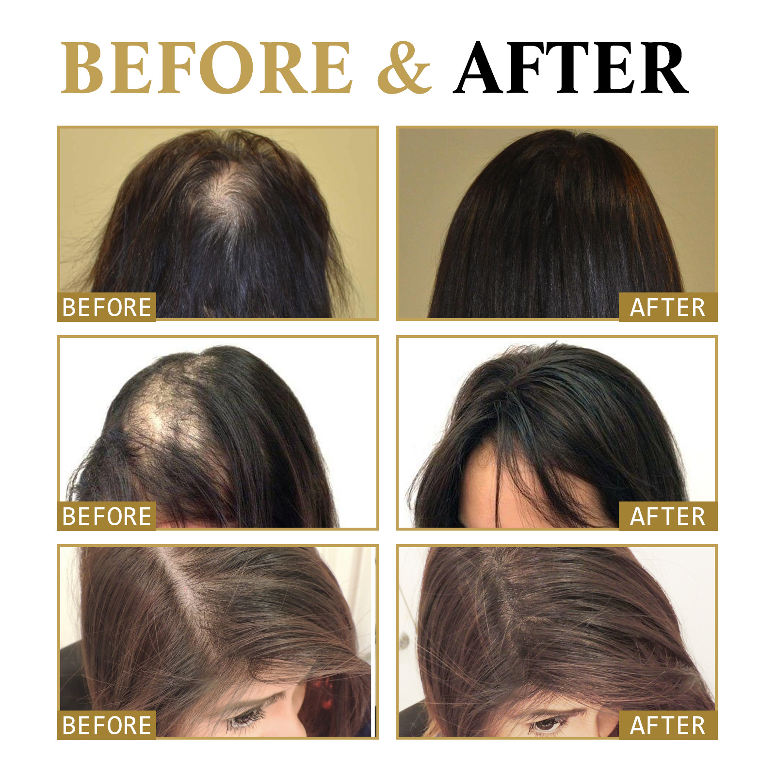 Anti Hair Loss Fast Essence Strengthens Hair Roots Repair Hereditary Postpartum Seborrheic Hair Loss Renewal Serum 20ml