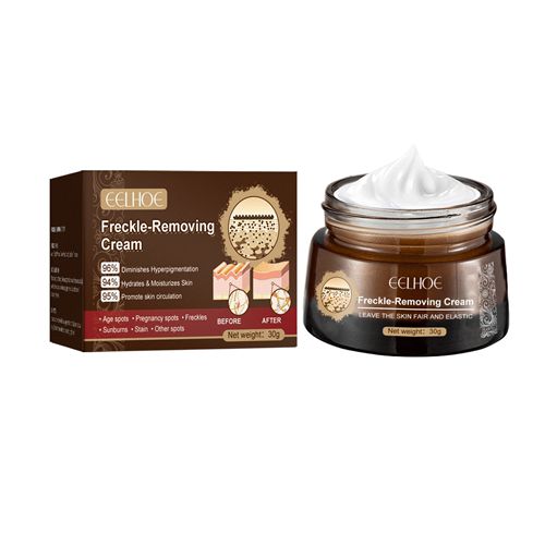 Freckle-Removing Cream Spot Off Freckle Whitening Fades Spots and Brightens Skin Tone Dark Spot Remover Moisturizing Skin Care