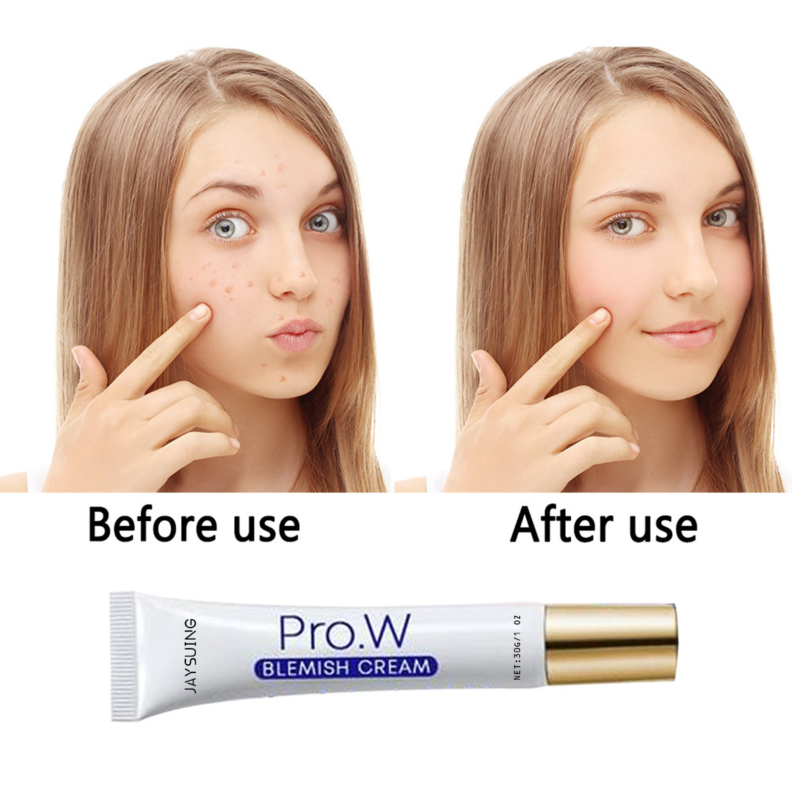 (1 PC) Acne Pockmarks Removal Face Cream Freckle Remover Facial Cream Lighten Acne Mark Acne Spot Cream Hydrating Lift Moisturizing Firming Repair Cream.
