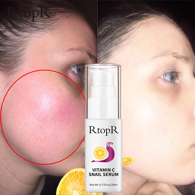 Snail Essence Vitamin C Moisturizing Skin Nourishing Face Serum Hydrating Care
