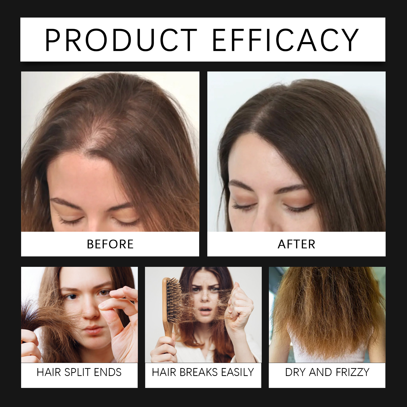 Hair Spray With Polygonum Multiflorum Root Extract Mild Daily Hair Care For Scalp Spray And Massage