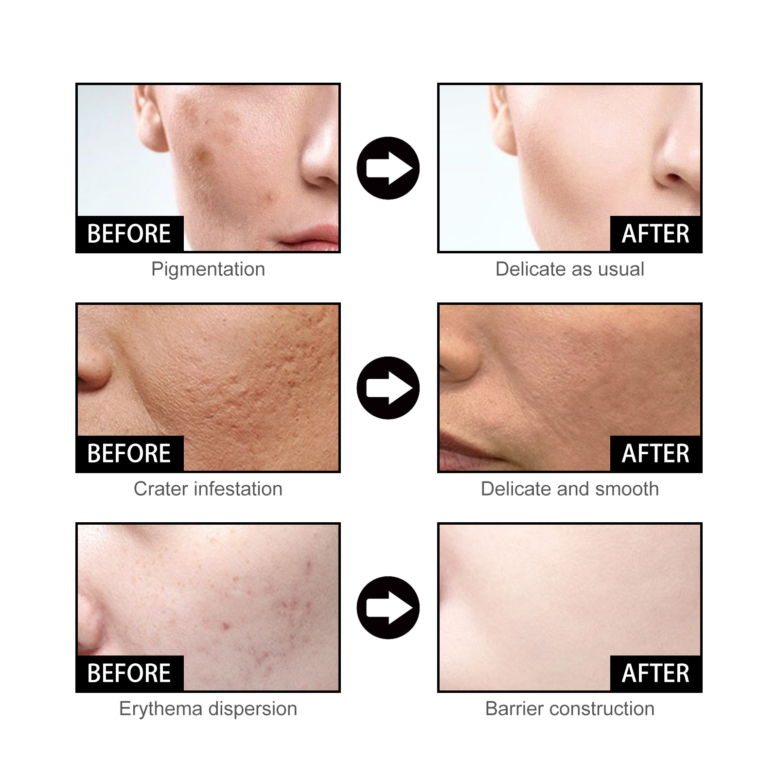 Niacinamide Face Serum Gentle Moisturizing Pore Care Brightening For Daily Skincare 50ml