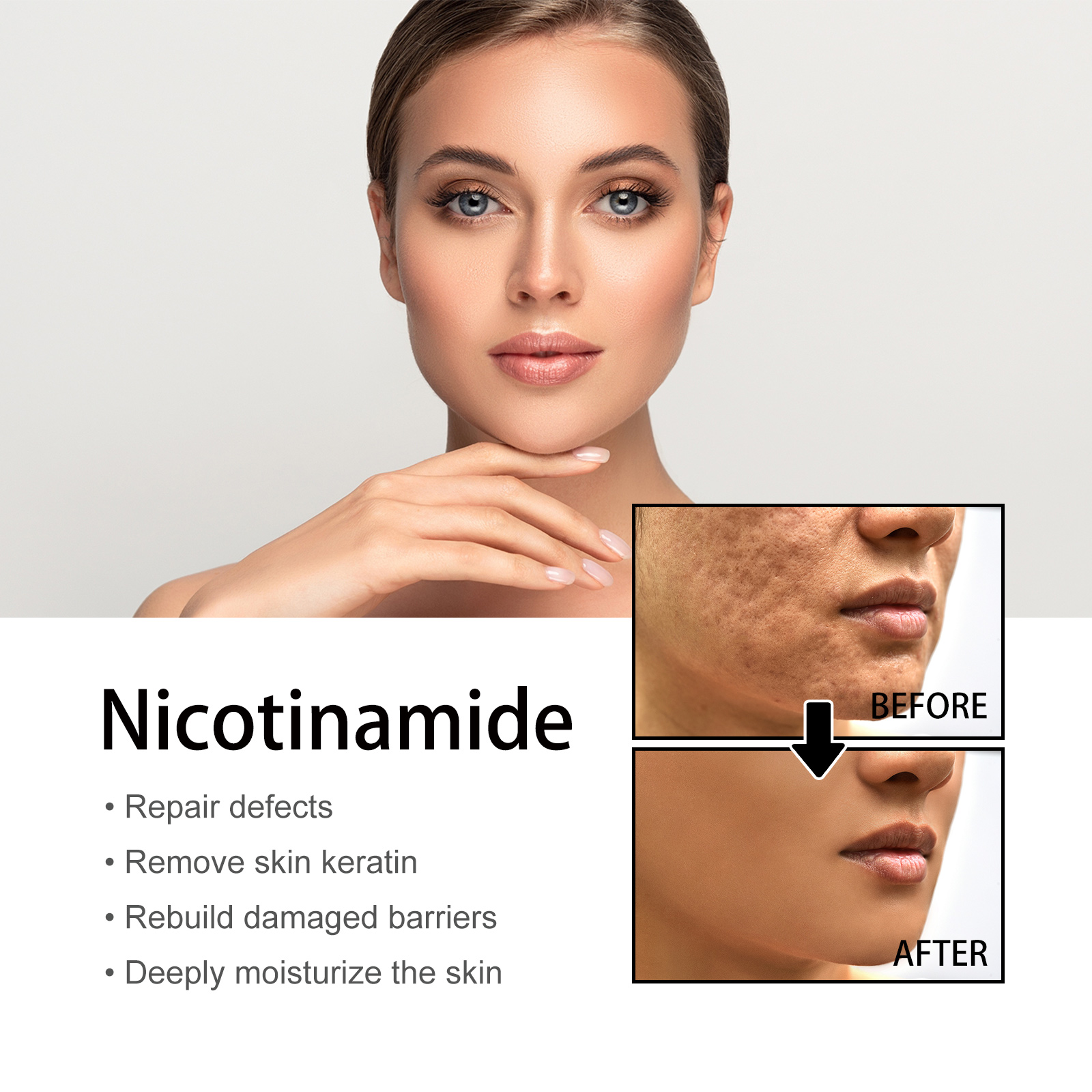 Niacinamide Face Serum Gentle Moisturizing Pore Care Brightening For Daily Skincare 50ml