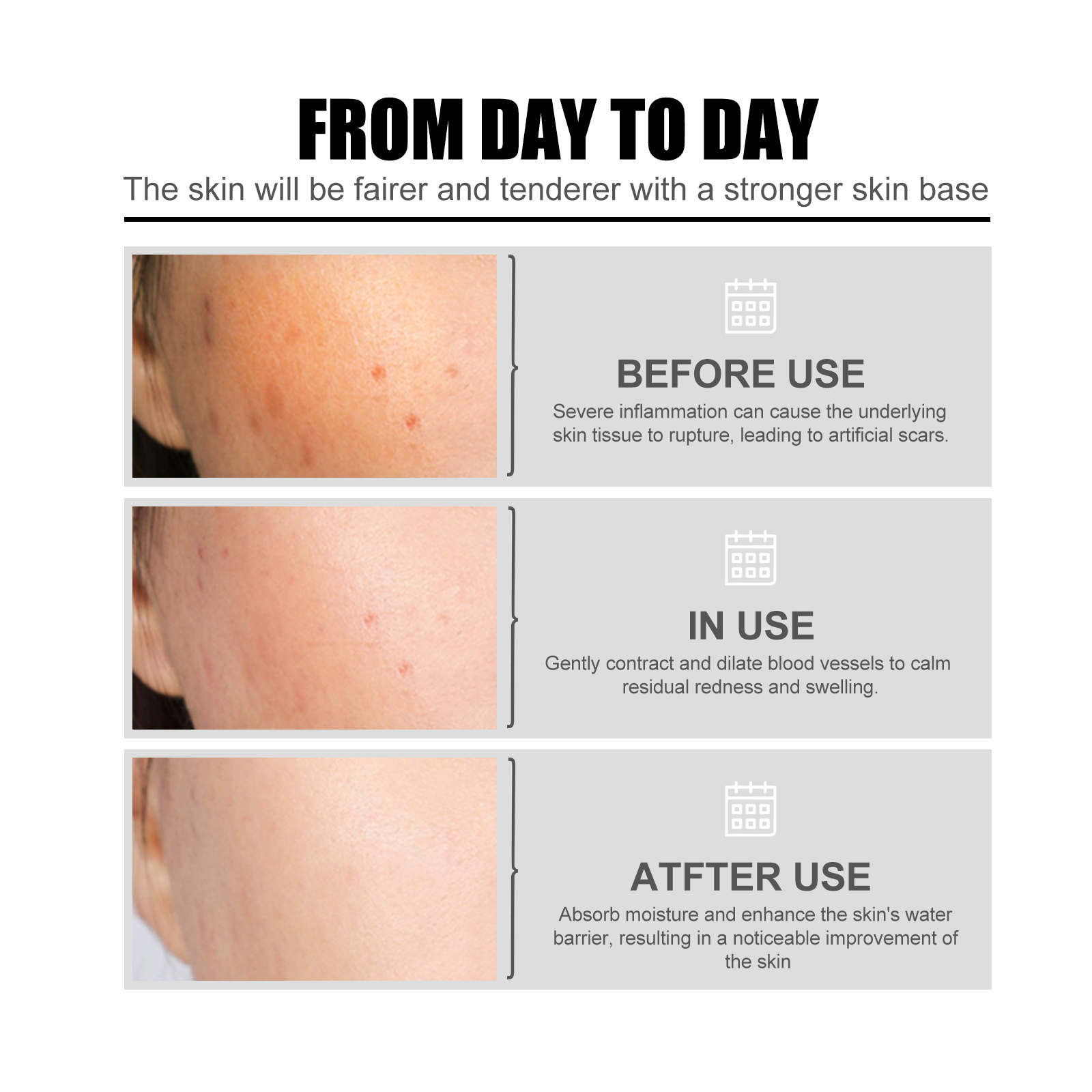 Niacinamide Face Serum Gentle Moisturizing Pore Care Brightening For Daily Skincare 50ml
