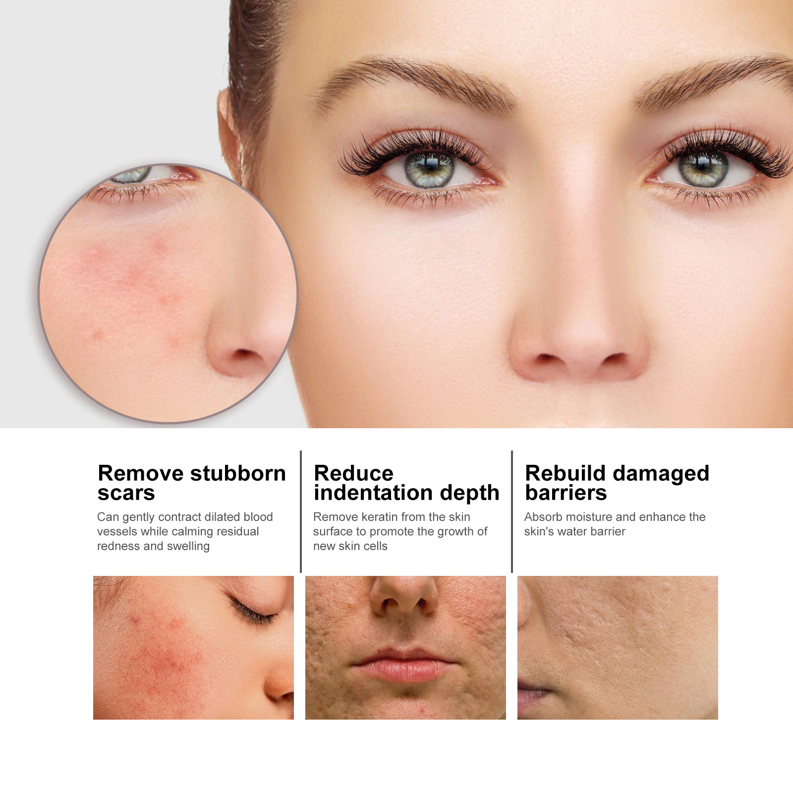 Niacinamide Face Serum Gentle Moisturizing Pore Care Brightening For Daily Skincare 50ml