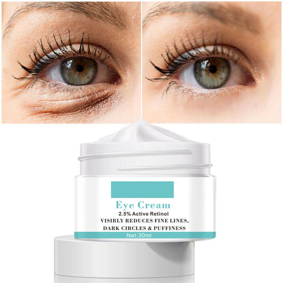 Magic Eye Cream-5 Seconds Instant Remove Eye Bags Dark Circles Eye Wrinkles 30ml
