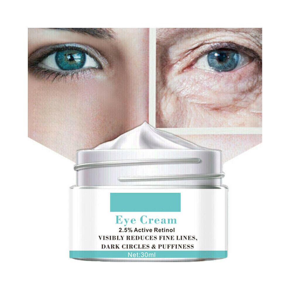 Magic Eye Cream-5 Seconds Instant Remove Eye Bags Dark Circles Eye Wrinkles 30ml