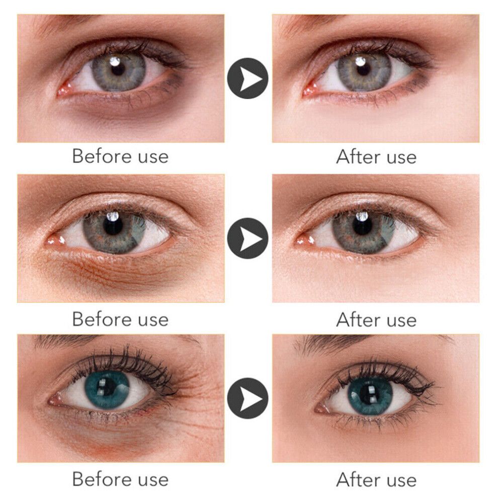 Magic Eye Cream-5 Seconds Instant Remove Eye Bags Dark Circles Eye Wrinkles 30ml