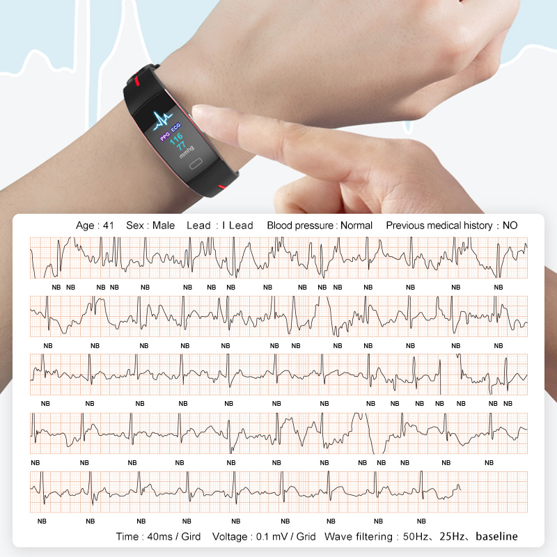 ECG PPG Smart Bracelet Heart Rate Blood Pressure Monitoring Watch Body Temperature Measure Smart Watches Men Women