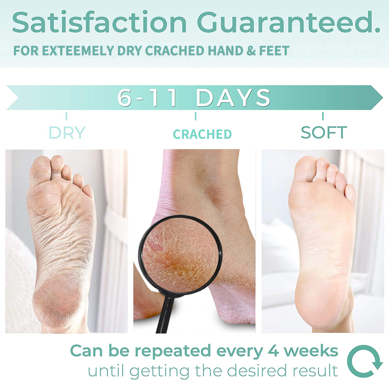 iBeaLee Anti Crack Foot Cream Repair Cream Repair Heel Cracked Dry Calluses Dead Skin Feet Peel Mask Herbal Hand Peeling Removal Feet Care 35ml