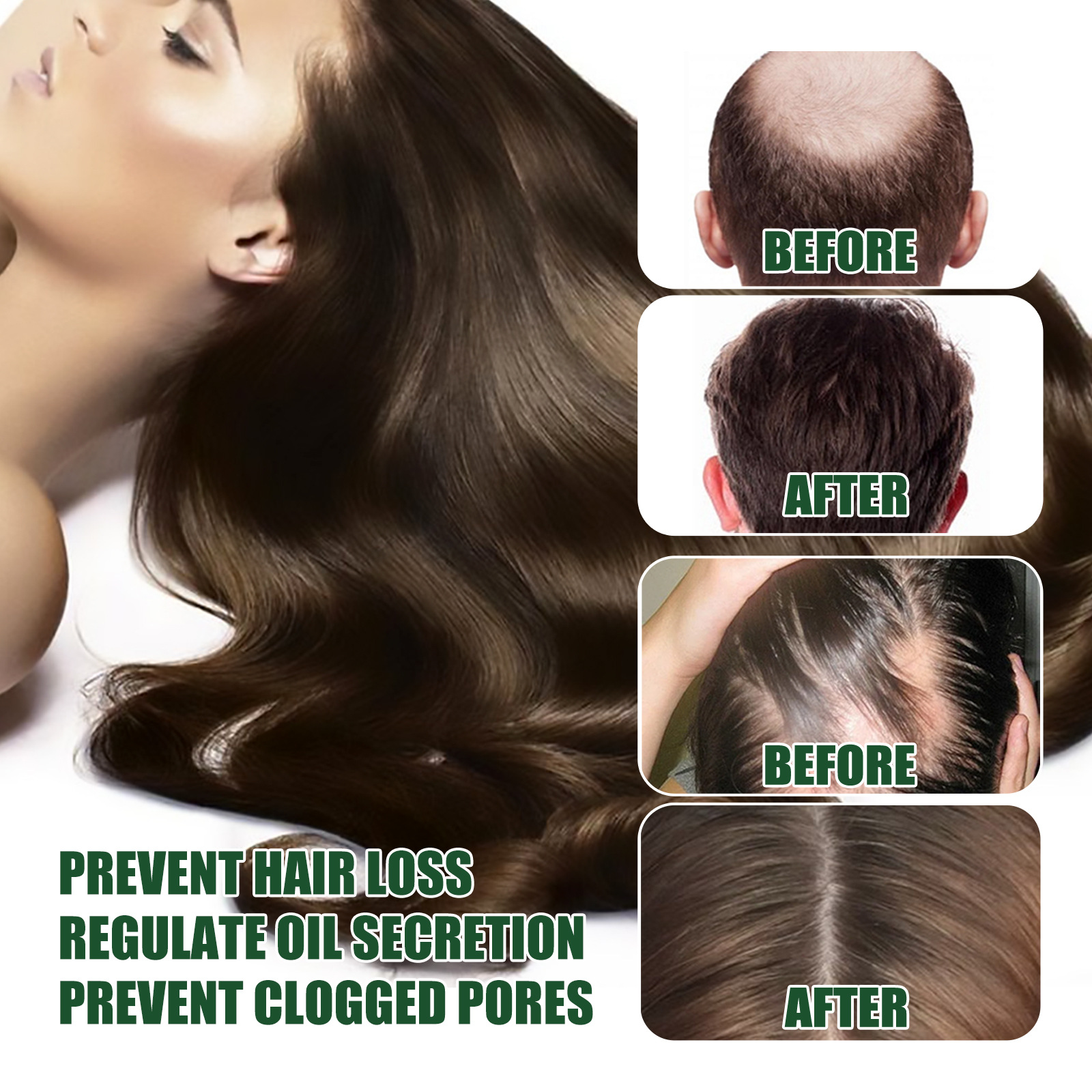 Ginger Hair Growth Essence Hair Care Oil 7 Day Ginger King Serum Nourishing Hair Nutrition Dense Hair Nutrient Solution 30ml
