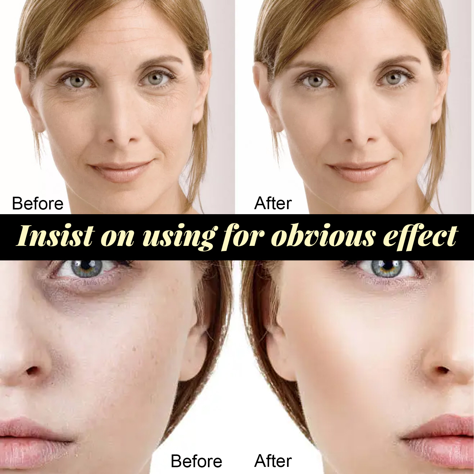 (20pcs Set) Protein Thread Lifting Face Lift Protein Lines Korean Protein Lifting Collagen Thread Plump Your Face Lift And Firm The Facial Contours Moisturizing
